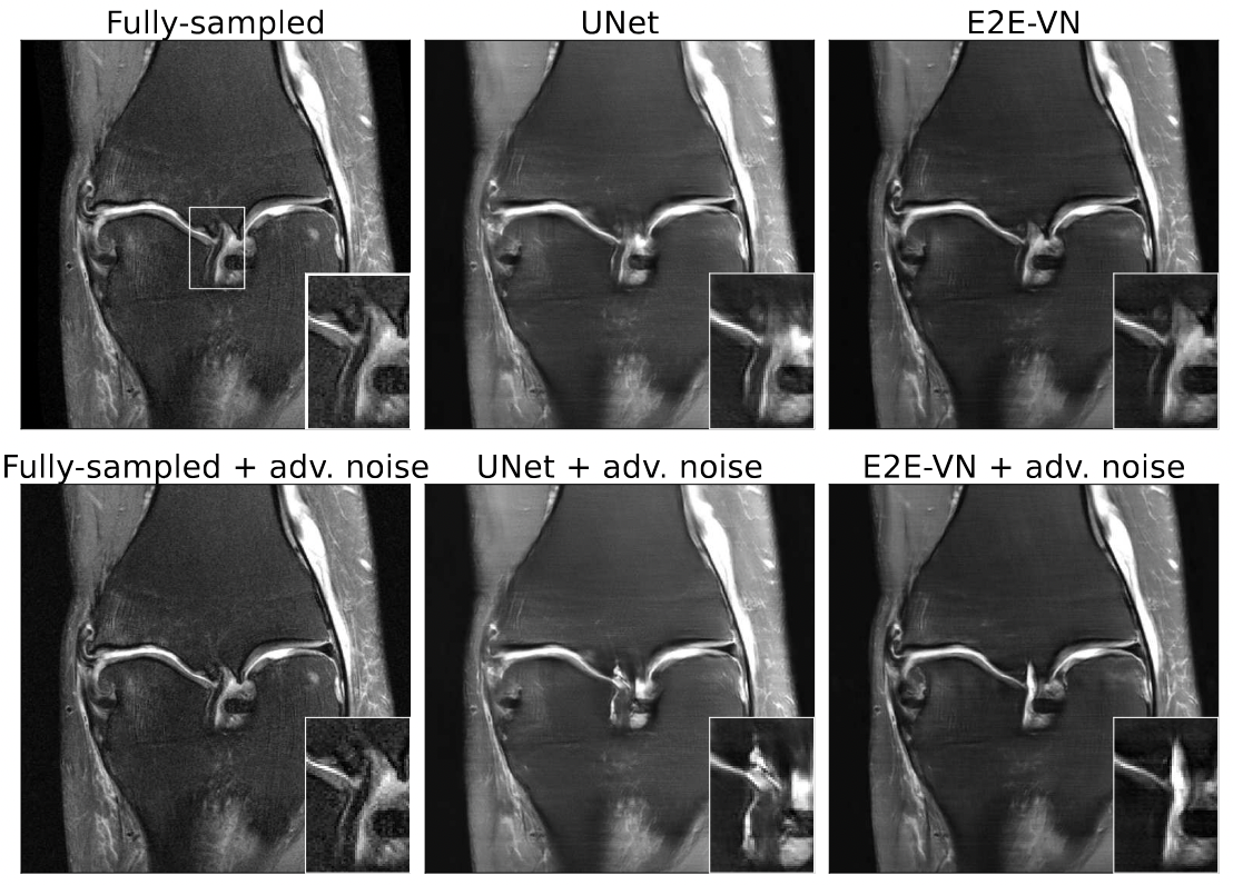 Adversarial Robustness of MR Image Reconstruction Under Realistic Perturbations